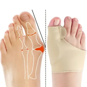 Corretor de Joanetes e Esporão Ortopédico - Conforto e Alívio pata os Pés